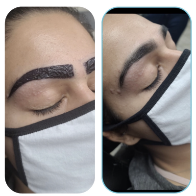 Face Contouring